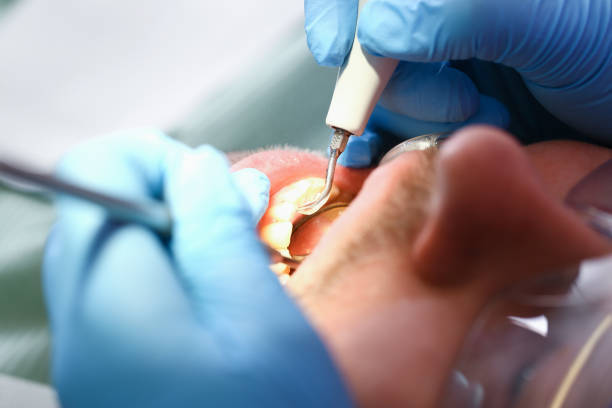 Best Emergency Dental Care for Broken or Chipped Teeth in East Flat Rock, NC