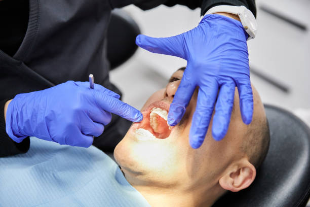 Best Emergency Root Canal Treatment in East Flat Rock, NC