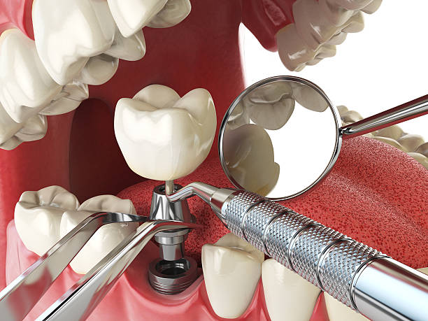 Best Cosmetic Emergency Dentistry in East Flat Rock, NC